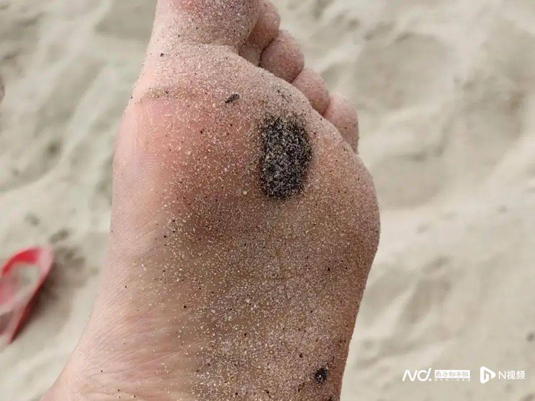 皇冠登3管理出租_“擦都擦不掉”！多名网友反映深圳大梅沙现黑色油污皇冠登3管理出租，味道刺鼻！官方回应