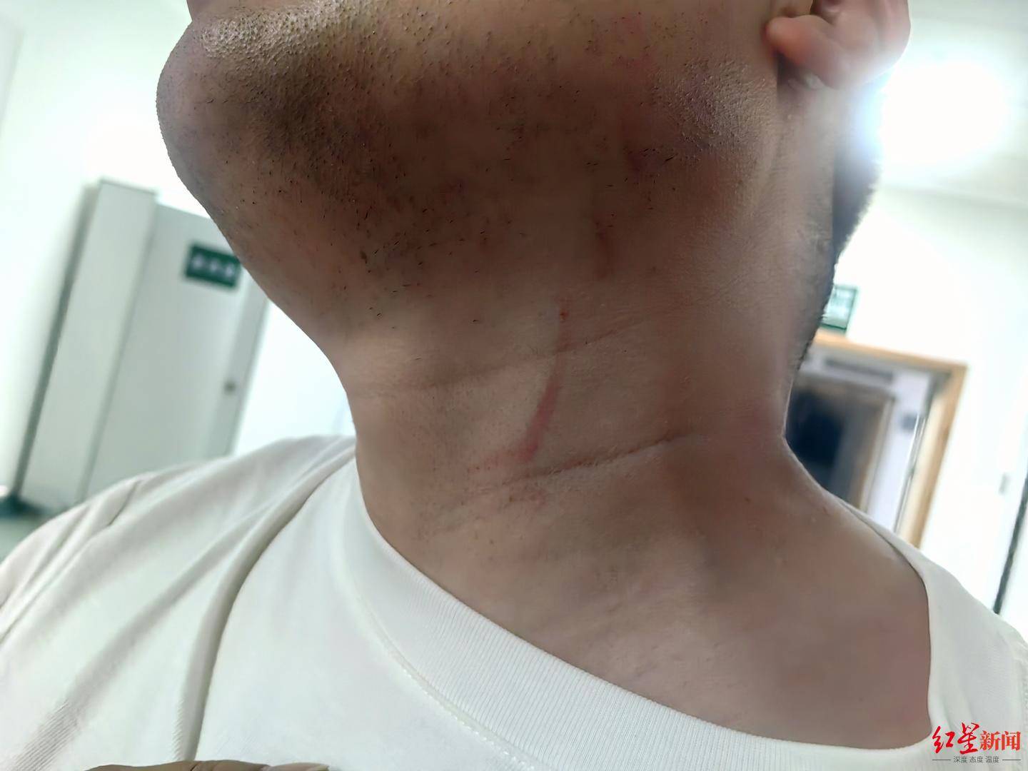 皇冠信用盘结算日是哪天_武汉男子拍摄违停时被当街殴打皇冠信用盘结算日是哪天，打人者被罚款500元，被打者称将提起行政复议并起诉