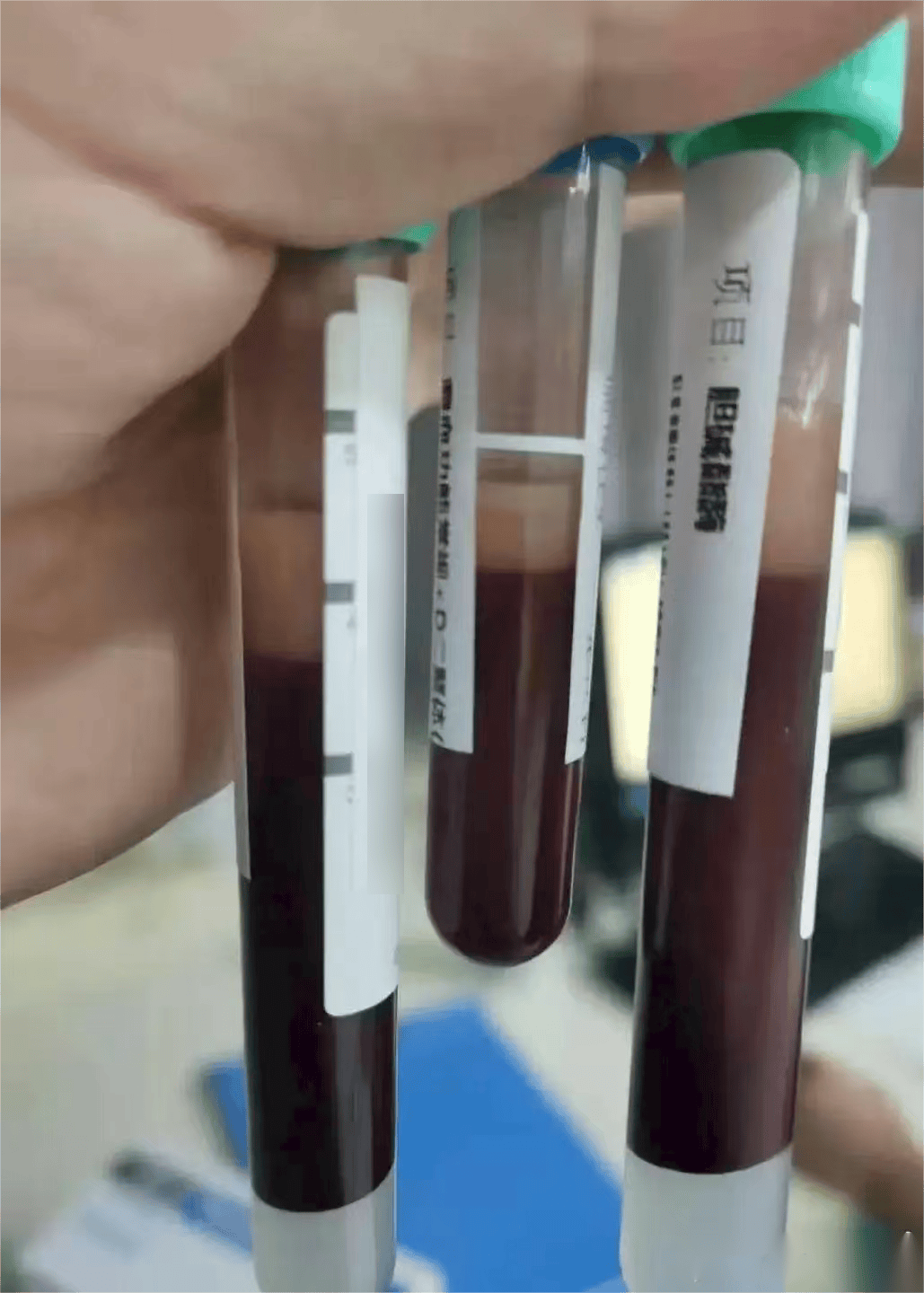 茅利塔尼亚vs多哥比賽_一口气干掉5只茅利塔尼亚vs多哥比賽,宁波男子被连夜送急诊!正大量上市!医生提醒:一次别超过2只