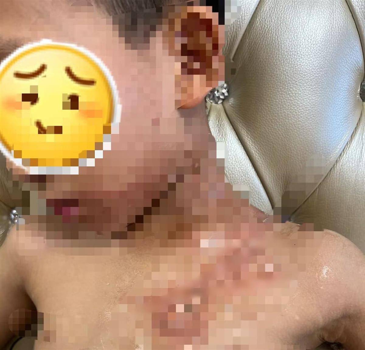 餐厅服务员端着酸菜鱼“追尾”撞上男孩巴黎圣日耳曼vs朗斯,致其被热汤烫伤胸口,合肥警方介入 | 巴黎圣日耳曼vs朗斯