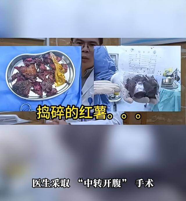 皇冠hga030_61岁男子将17cm红薯塞入肛门皇冠hga030，半夜疼痛难忍被迫就医，医生：尺寸过大，得开腹