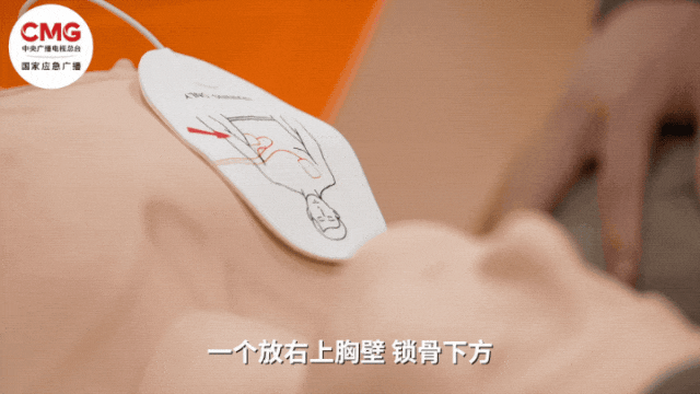 信用平台出租_山东一市民突发心梗信用平台出租,其家属砸窗取出陌生人车内AED用于急救;车主回应:砸就砸吧,人命比玻璃重要