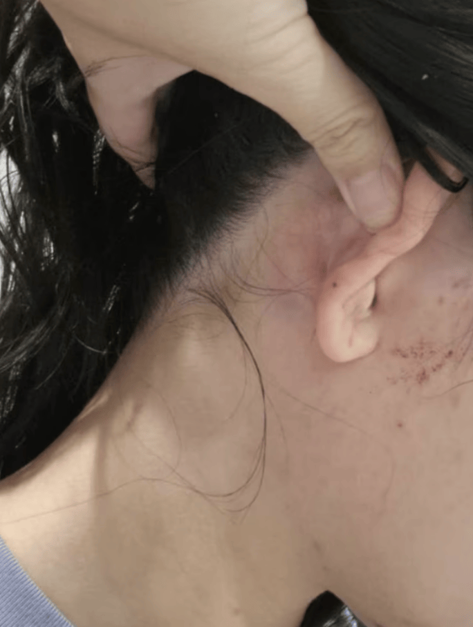 皇冠信用盘APP下载_使馆回应中国女子在堪培拉遭陌生人殴打：要求澳警方彻查案件