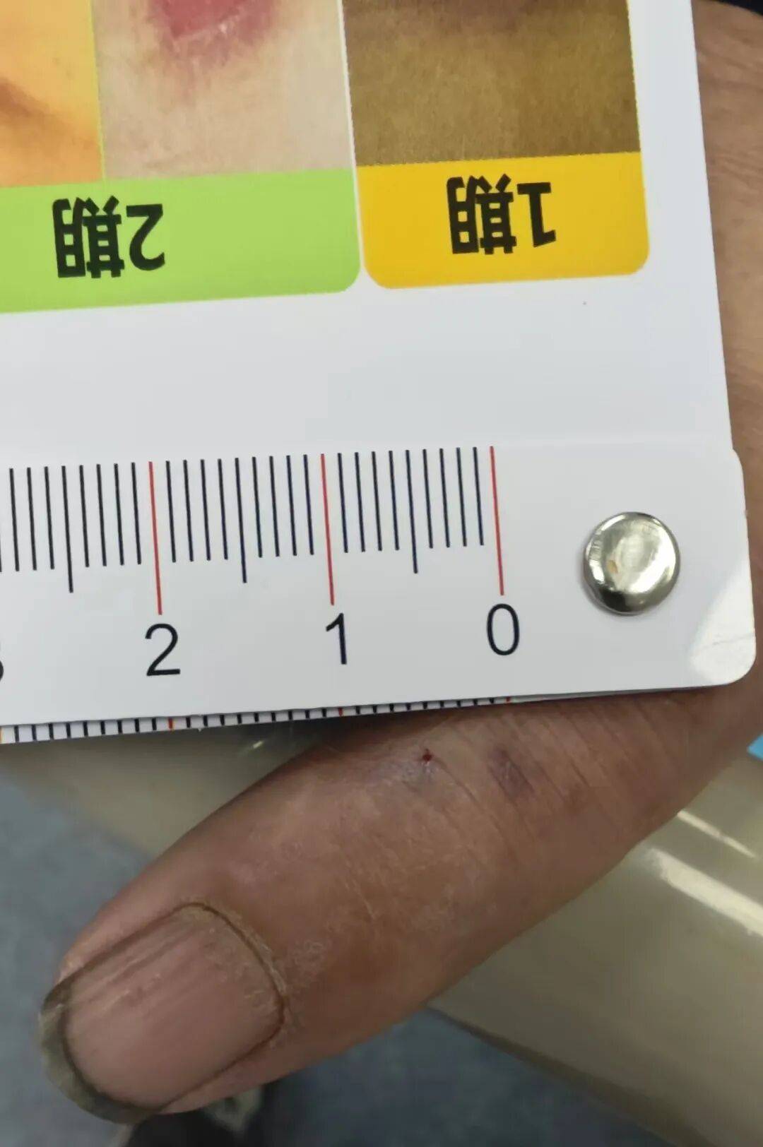 意大利甲组联赛_男子晚上抓黄鳝意大利甲组联赛，摸上来一条毒蛇：狠狠咬住手不放！